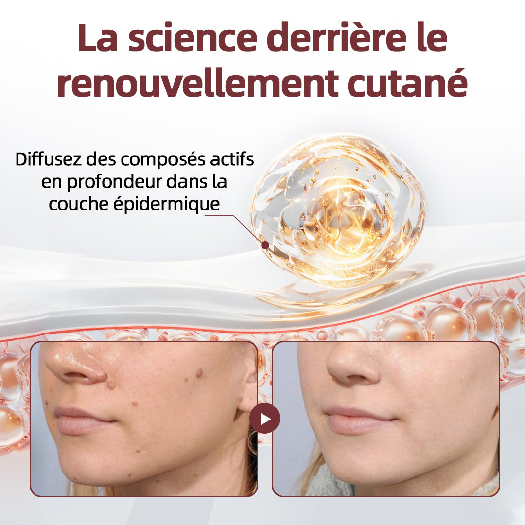 CureVivo® KeraErase 50 OFF