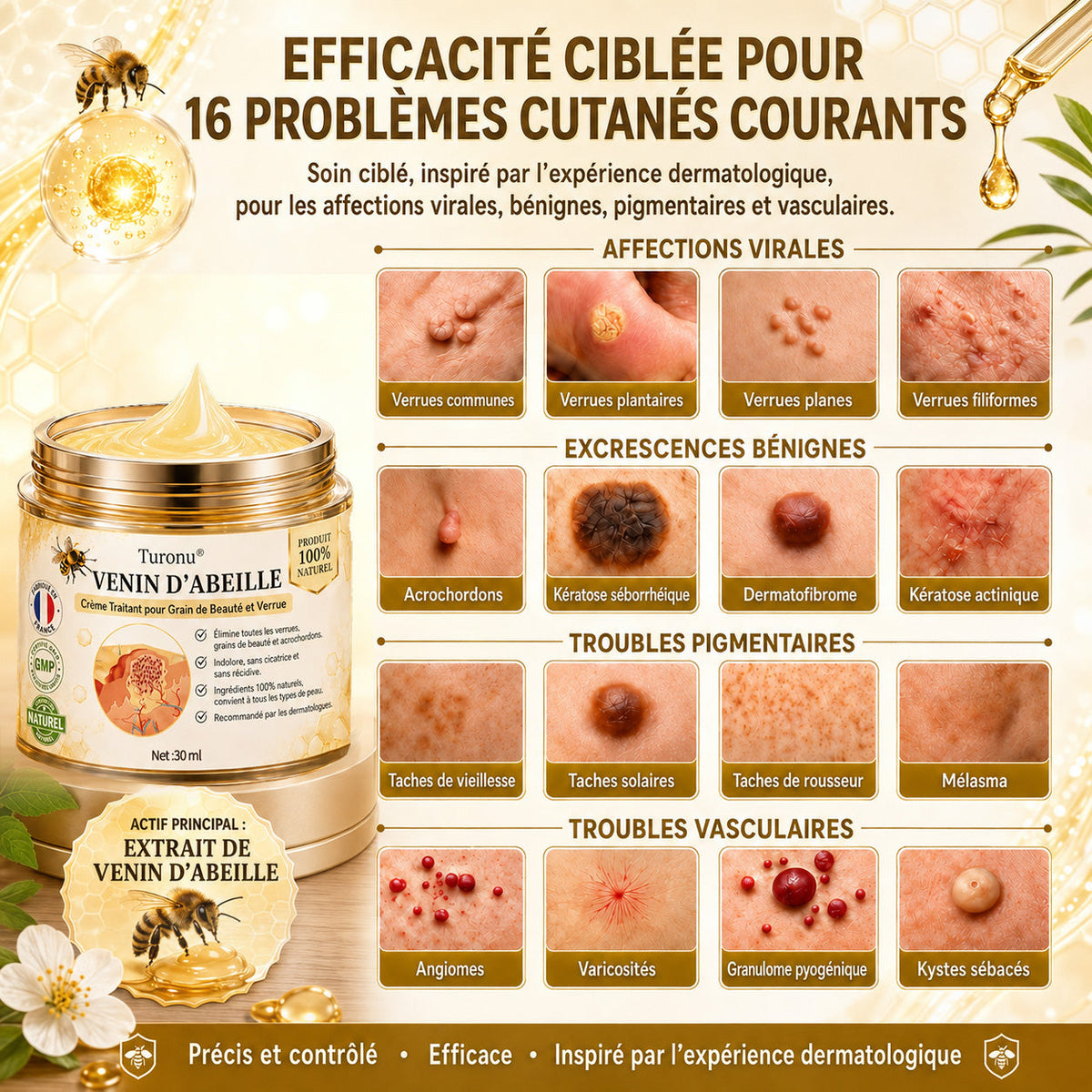 Turonu®💐 traitement avancé au venin d'abeille contre les verrues et les imperfections cutanées 👨‍⚕️ Inspiré de la science dermatologique | Soin ciblé à domicile