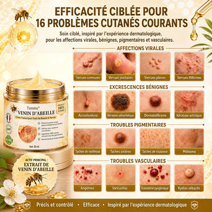 Turonu®💐 traitement avancé au venin d'abeille contre les verrues et les imperfections cutanées 👨‍⚕️ Inspiré de la science dermatologique | Soin ciblé à domicile