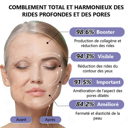🤸🏻‍♂️ Boutique Officielle de la Marque | Crème Roulante Turonu® Réductrice de Rides & Lifting 🧴 Une peau plus lisse en seulement 3 jours