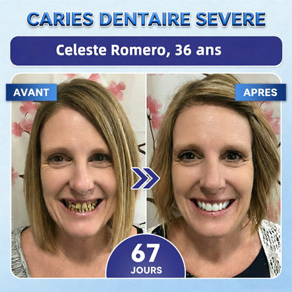 𝐆𝐚𝐫𝐚𝐠𝐞𝐋𝐢𝐧𝐞®®🇫🇷🦷 Bandes buccales Tideglusib à dissolution rapide pour la réparation des dents et des gencives 😁 (Favorise la réparation dentaire et aide à soulager l'inconfort des gencives ainsi que d'autres problèmes bucco-dentaires courants)