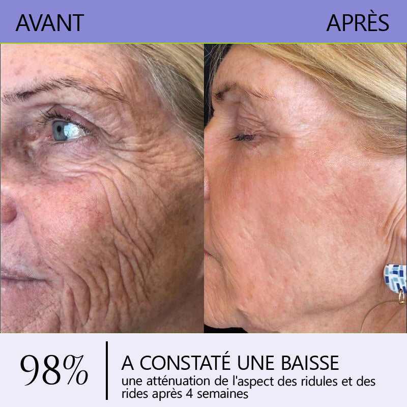 🤸🏻‍♂️ Boutique Officielle de la Marque | Crème Roulante Turonu® Réductrice de Rides & Lifting 🧴 Une peau plus lisse en seulement 3 jours