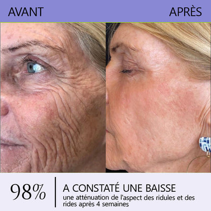 🤸🏻‍♂️ Boutique Officielle de la Marque | Crème Roulante Turonu® Réductrice de Rides & Lifting 🧴 Une peau plus lisse en seulement 3 jours