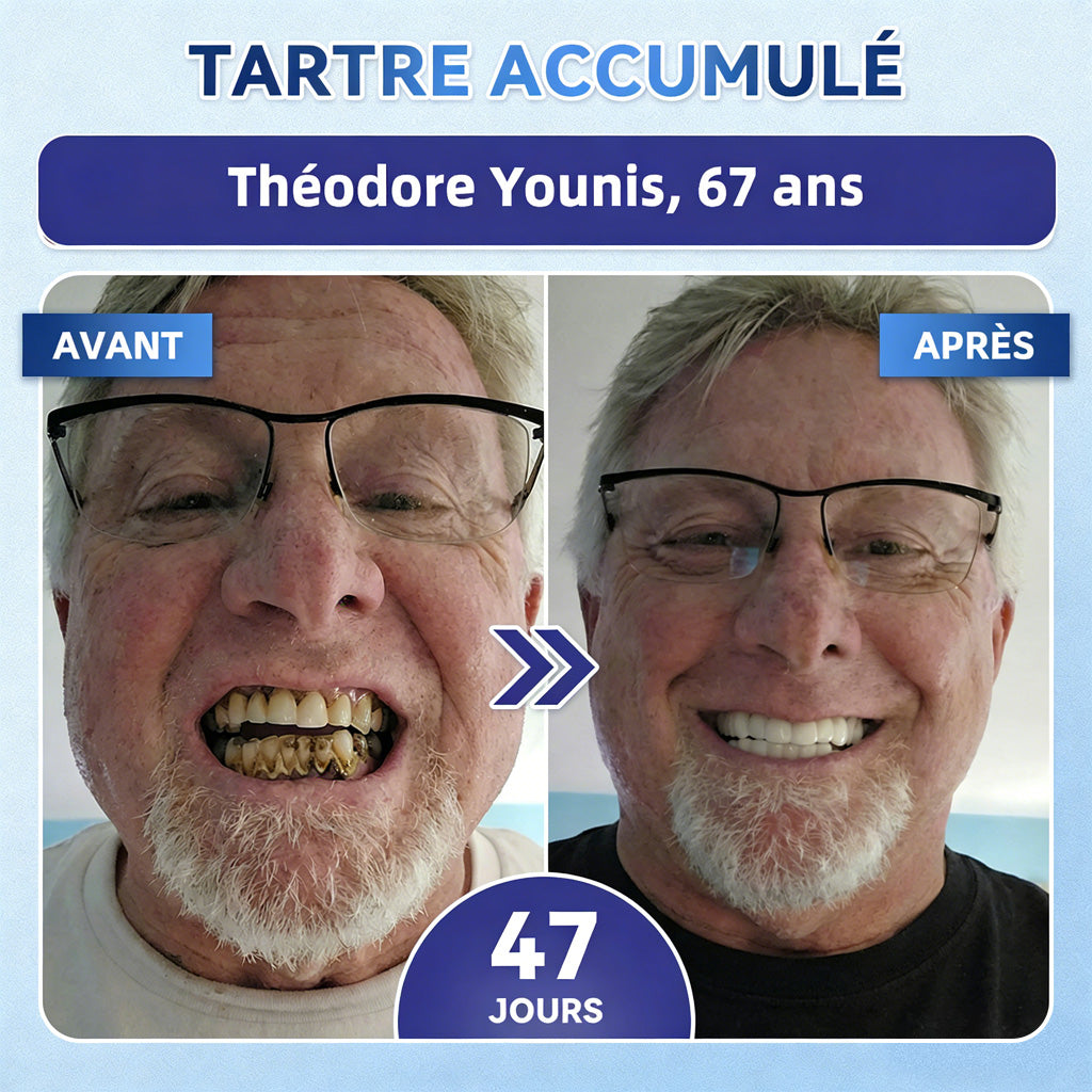𝐆𝐚𝐫𝐚𝐠𝐞𝐋𝐢𝐧𝐞®®🇫🇷🦷 Bandes buccales Tideglusib à dissolution rapide pour la réparation des dents et des gencives 😁 (Favorise la réparation dentaire et aide à soulager l'inconfort des gencives ainsi que d'autres problèmes bucco-dentaires courants)