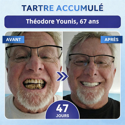 𝐆𝐚𝐫𝐚𝐠𝐞𝐋𝐢𝐧𝐞®®🇫🇷🦷 Bandes buccales Tideglusib à dissolution rapide pour la réparation des dents et des gencives 😁 (Favorise la réparation dentaire et aide à soulager l'inconfort des gencives ainsi que d'autres problèmes bucco-dentaires courants)