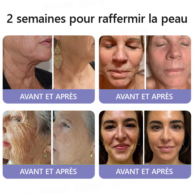 🤸🏻‍♂️ Boutique Officielle de la Marque | Crème Roulante Turonu® Réductrice de Rides & Lifting 🧴 Une peau plus lisse en seulement 3 jours