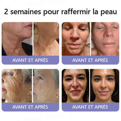 🤸🏻‍♂️ Boutique Officielle de la Marque | Crème Roulante Turonu® Réductrice de Rides & Lifting 🧴 Une peau plus lisse en seulement 3 jours