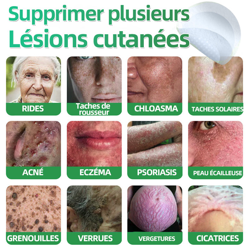 👩🏼‍⚕️ Patchs hydrocolloïdes à micro-aiguilles 2 en 1 𝐇𝐮𝐝𝐫𝐨𝐬® | Élimine les grains de beauté en relief, l'acné, les verrues planes et les acrochordons | Patchs invisibles pour le visage et le corps | 144 patchs