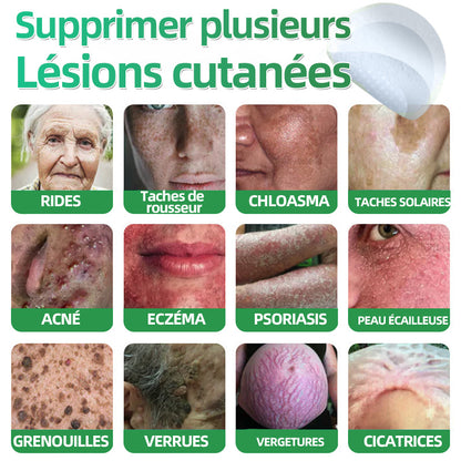 👩🏼‍⚕️ Patchs hydrocolloïdes à micro-aiguilles 2 en 1 𝐇𝐮𝐝𝐫𝐨𝐬® | Élimine les grains de beauté en relief, l'acné, les verrues planes et les acrochordons | Patchs invisibles pour le visage et le corps | 144 patchs