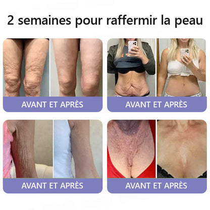 🤸🏻‍♂️ Boutique Officielle de la Marque | Crème Roulante Turonu® Réductrice de Rides & Lifting 🧴 Une peau plus lisse en seulement 3 jours