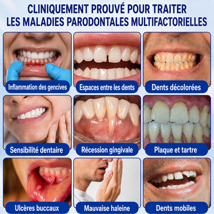 🧑‍⚕️🍃🦷GarageLine® GumRevive Gel réparateur parodontal