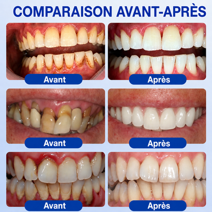 🧑‍⚕️🍃🦷GarageLine® GumRevive Gel réparateur parodontal