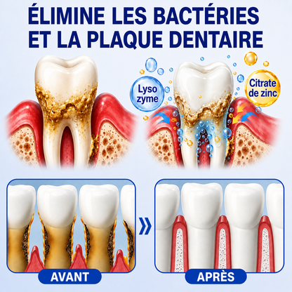🧑‍⚕️🍃🦷GarageLine® GumRevive Gel réparateur parodontal