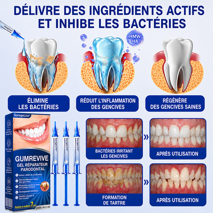 🧑‍⚕️🍃🦷GarageLine® GumRevive Gel réparateur parodontal