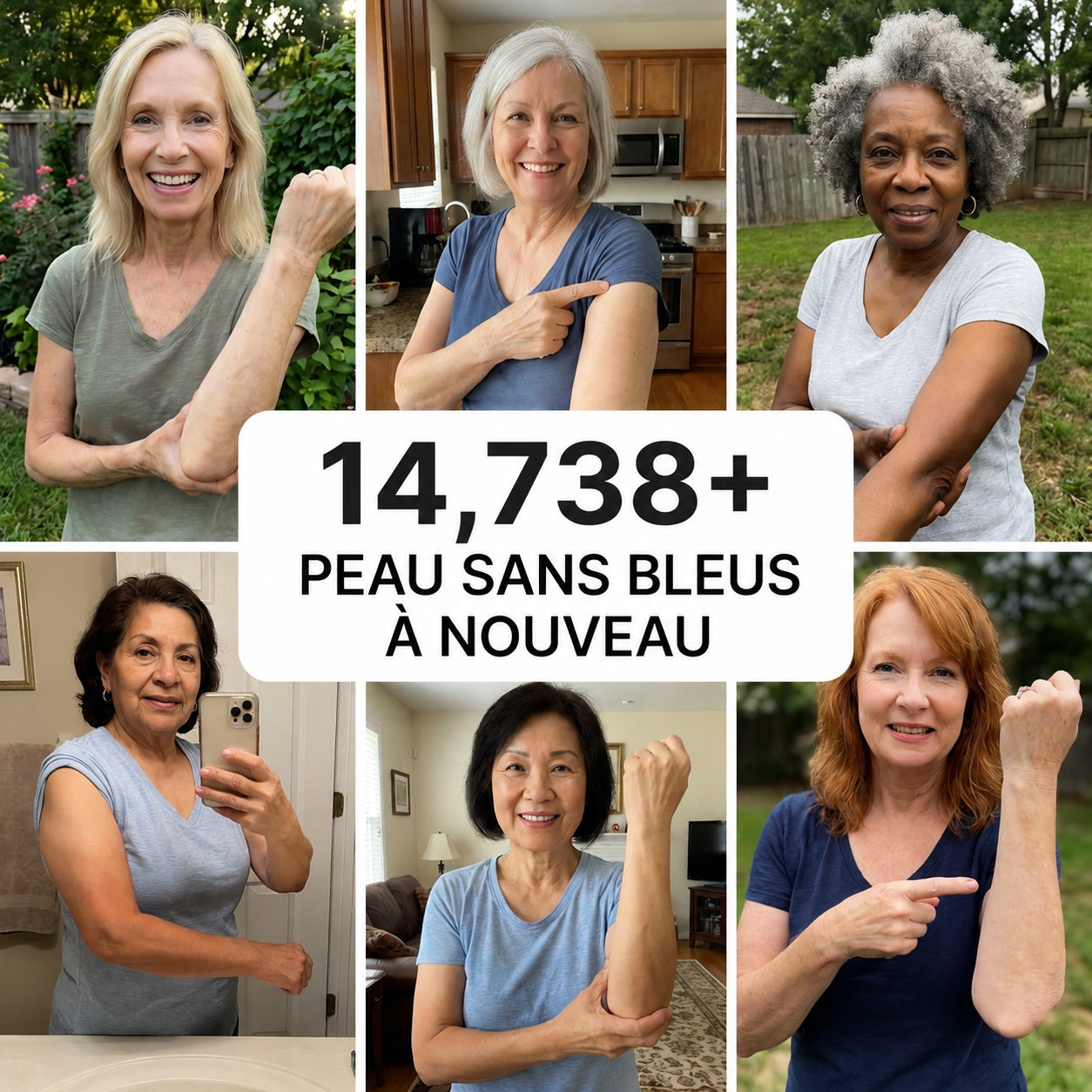 💥 Plus de 100 000 exemplaires vendus 💕 - CureVivo® Crème Réparatrice Anti-Bleus & Fortifiante