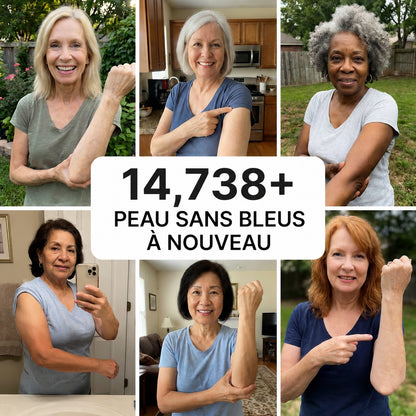 💥 Plus de 100 000 exemplaires vendus 💕 - CureVivo® Crème Réparatrice Anti-Bleus & Fortifiante