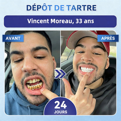 𝐆𝐚𝐫𝐚𝐠𝐞𝐋𝐢𝐧𝐞®®🇫🇷🦷 Bandes buccales Tideglusib à dissolution rapide pour la réparation des dents et des gencives 😁 (Favorise la réparation dentaire et aide à soulager l'inconfort des gencives ainsi que d'autres problèmes bucco-dentaires courants)