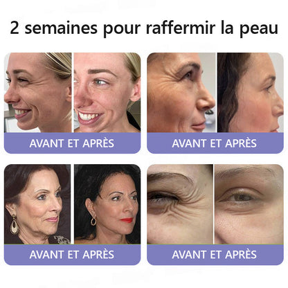 🤸🏻‍♂️ Boutique Officielle de la Marque | Crème Roulante Turonu® Réductrice de Rides & Lifting 🧴 Une peau plus lisse en seulement 3 jours