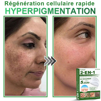 👩🏻‍⚕️Patchs hydrocolloïdes à micro-aiguilles 2 en 1 Hudros® | Élimine les grains de beauté en relief, l'acné, les verrues planes et les acrochordons | Patchs invisibles pour le visage et le corps | 144 patchs