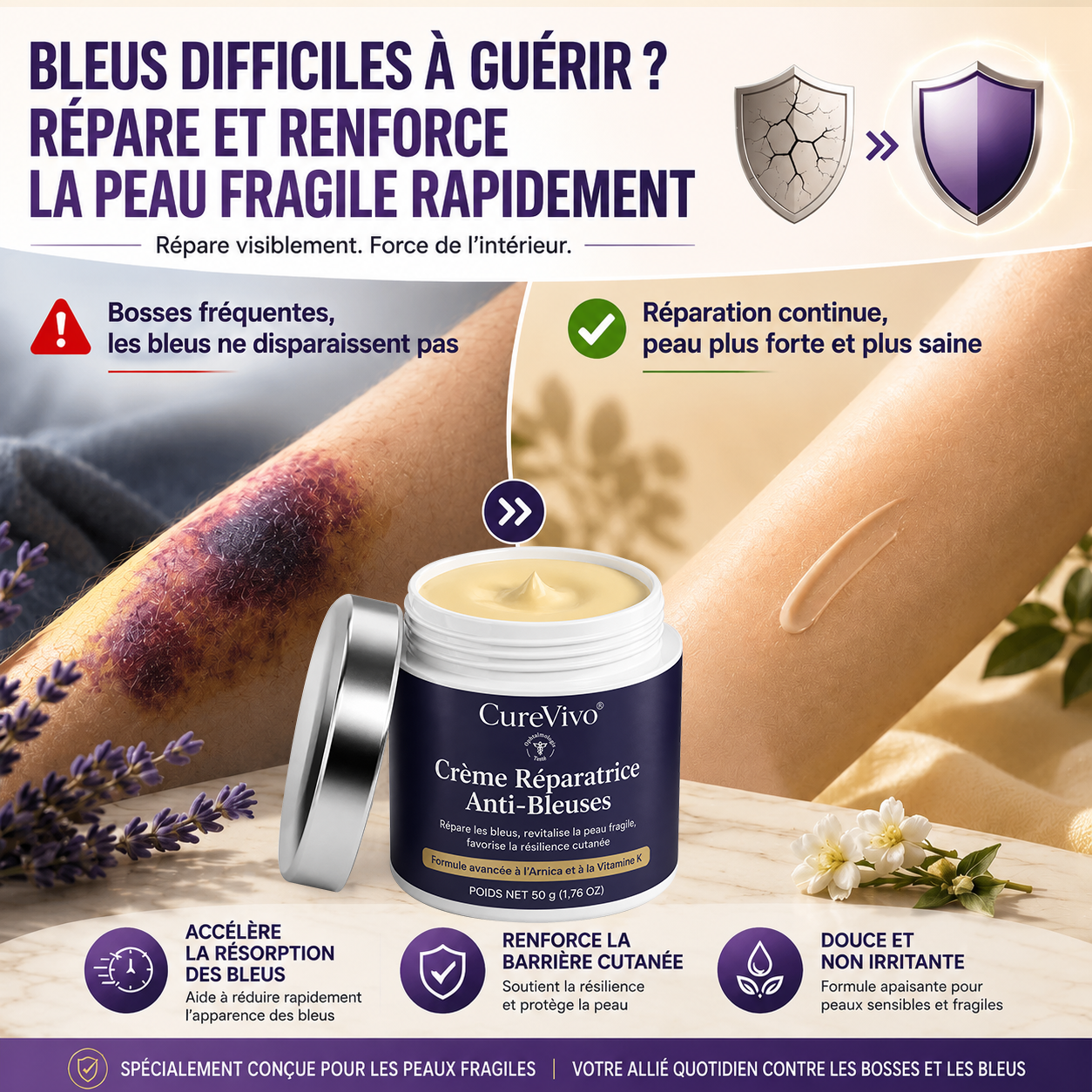 💥 Plus de 100 000 exemplaires vendus 💕 - CureVivo® Crème Réparatrice Anti-Bleus & Fortifiante