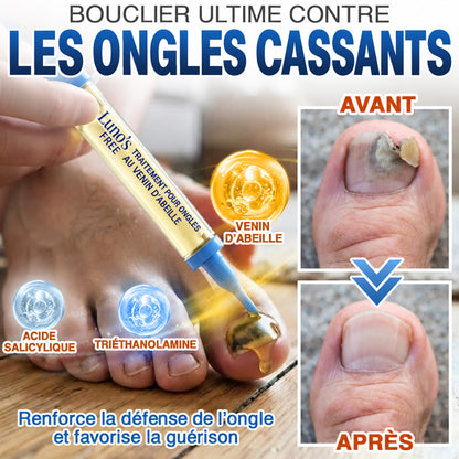 🇫🇷 Turonu® FungiFree 🐝 Soin Intensif contre les Mycoses, les Ongles Jaunis, Épais et Cassants ✨