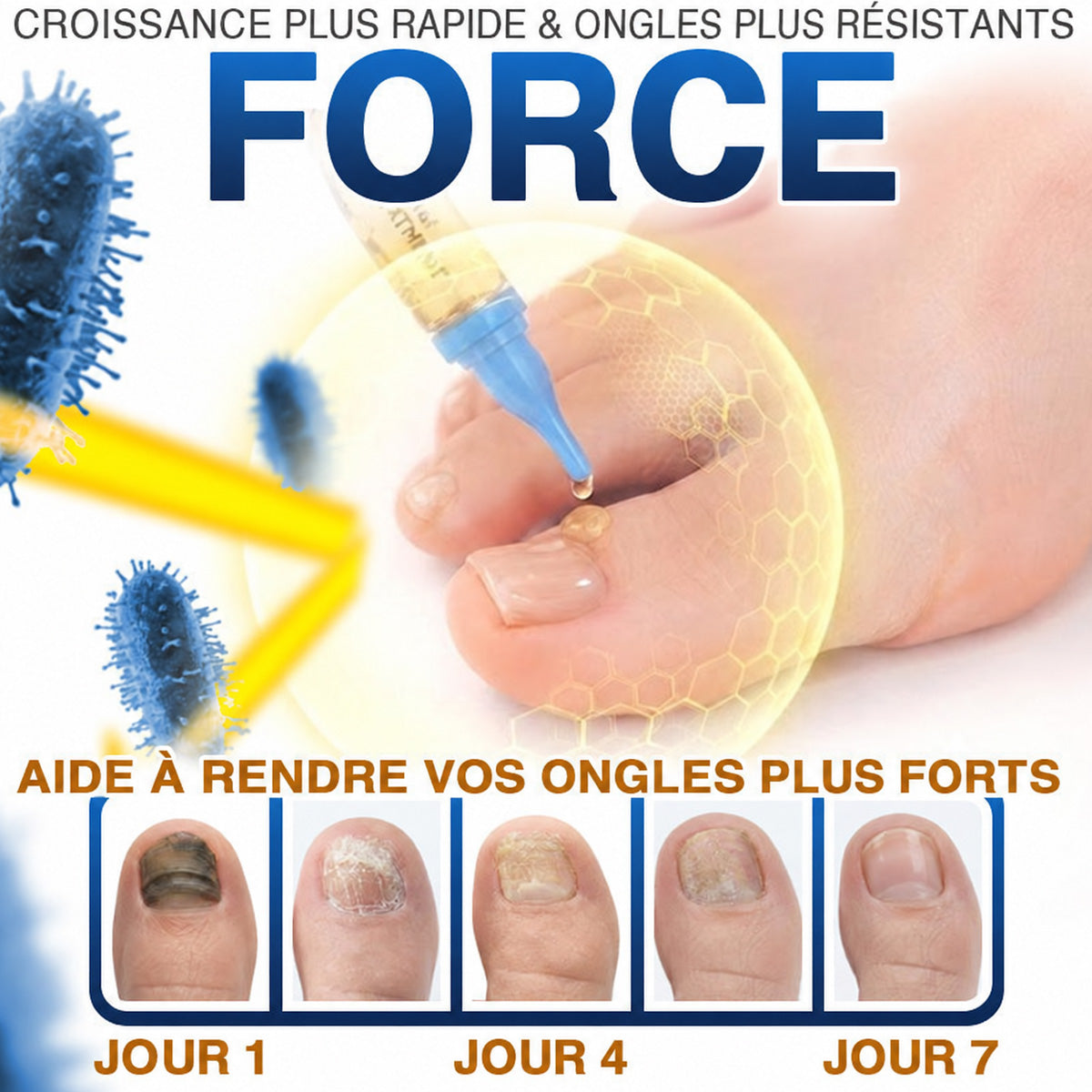 🇫🇷 Turonu® FungiFree 🐝 Soin Intensif contre les Mycoses, les Ongles Jaunis, Épais et Cassants ✨