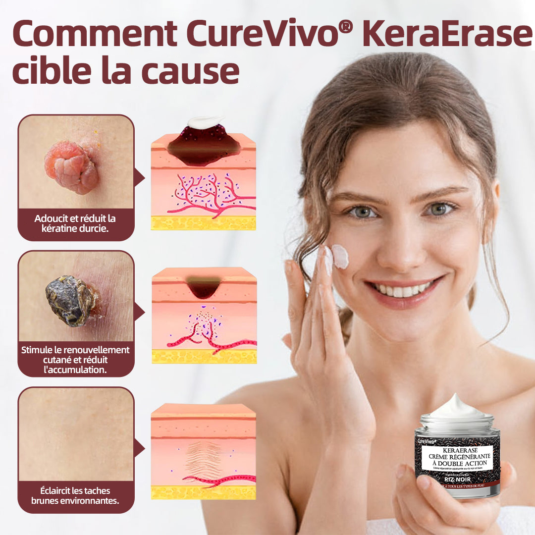 CureVivo® KeraErase 50 OFF