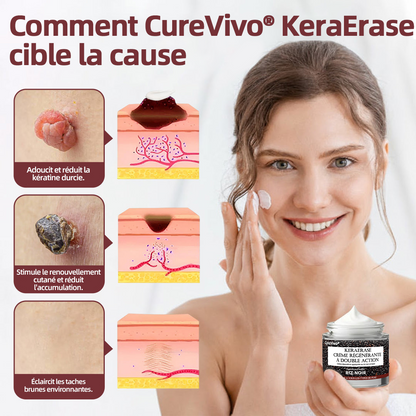 CureVivo® KeraErase 50 OFF