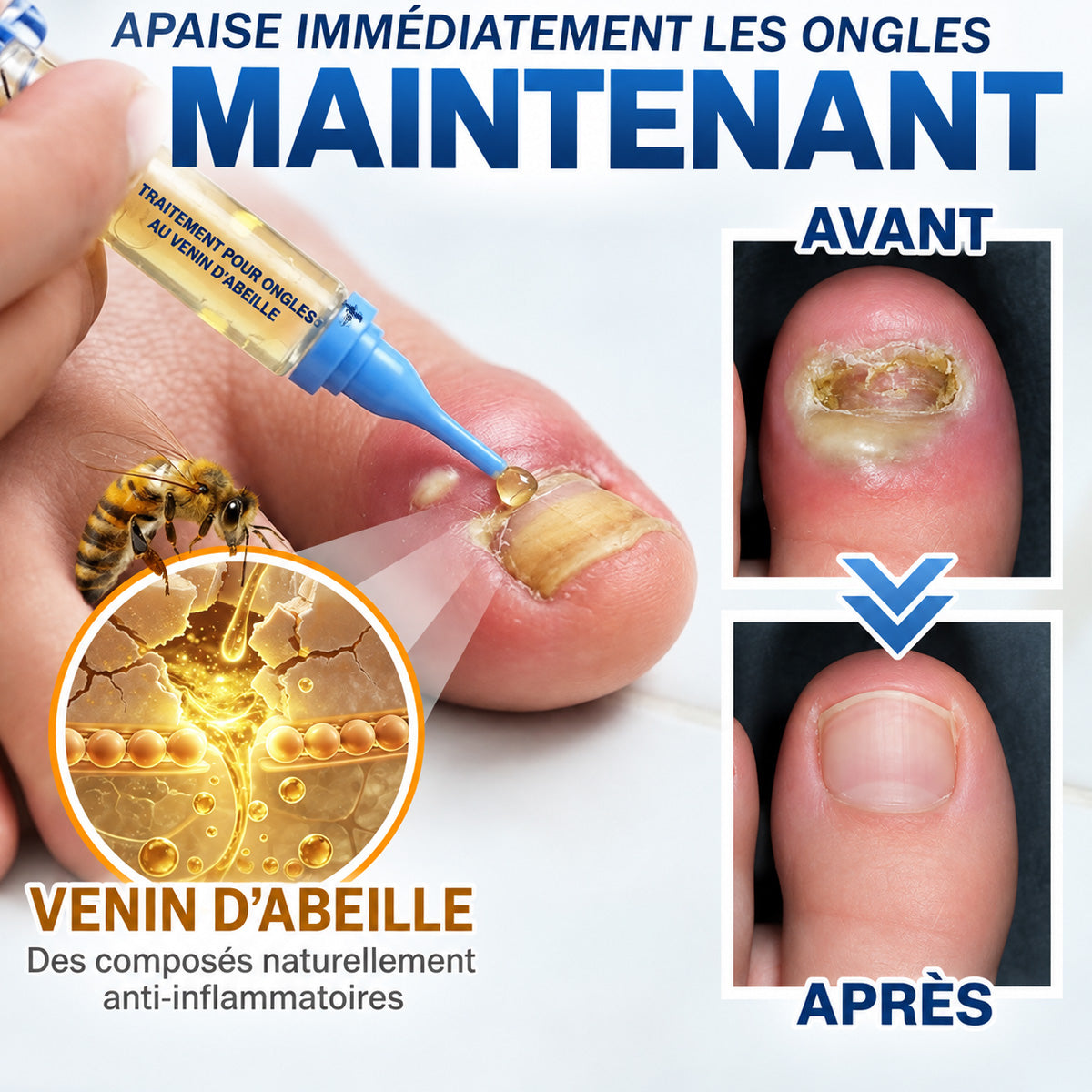 🇫🇷 Turonu® FungiFree 🐝 Soin Intensif contre les Mycoses, les Ongles Jaunis, Épais et Cassants ✨