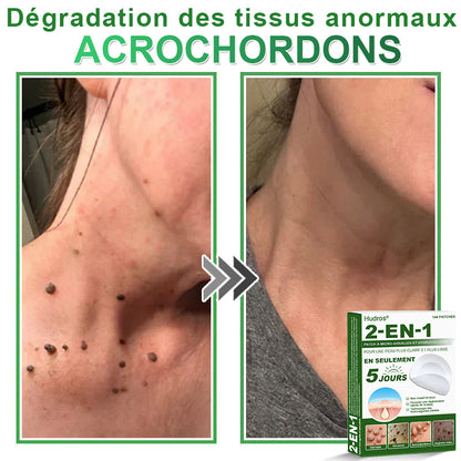 👩🏻‍⚕️Patchs hydrocolloïdes à micro-aiguilles 2 en 1 Hudros® | Élimine les grains de beauté en relief, l'acné, les verrues planes et les acrochordons | Patchs invisibles pour le visage et le corps | 144 patchs