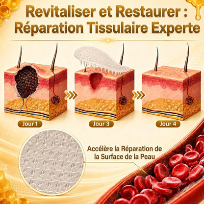📣 Boutique officielle phare | CureVivo® 🐝 Patch à micro-aiguilles au venin d'abeille (pour les verrues, les taches de vieillesse et les imperfections)🐝