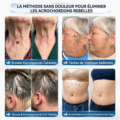 🖤CureVivo® Crème 7‑Jours pour éliminer les marques cutanées et les taches (Formule indolore – Sans cicatrices)🤗