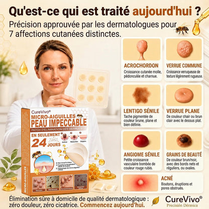 📣 Boutique officielle phare | CureVivo® 🐝 Patch à micro-aiguilles au venin d'abeille (pour les verrues, les taches de vieillesse et les imperfections)🐝