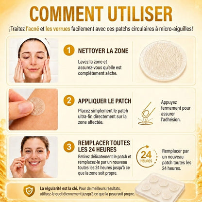 📣 Boutique officielle phare | CureVivo® 🐝 Patch à micro-aiguilles au venin d'abeille (pour les verrues, les taches de vieillesse et les imperfections)🐝