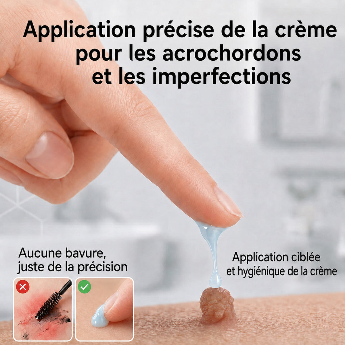 🖤CureVivo® Crème 7‑Jours pour éliminer les marques cutanées et les taches (Formule indolore – Sans cicatrices)🤗