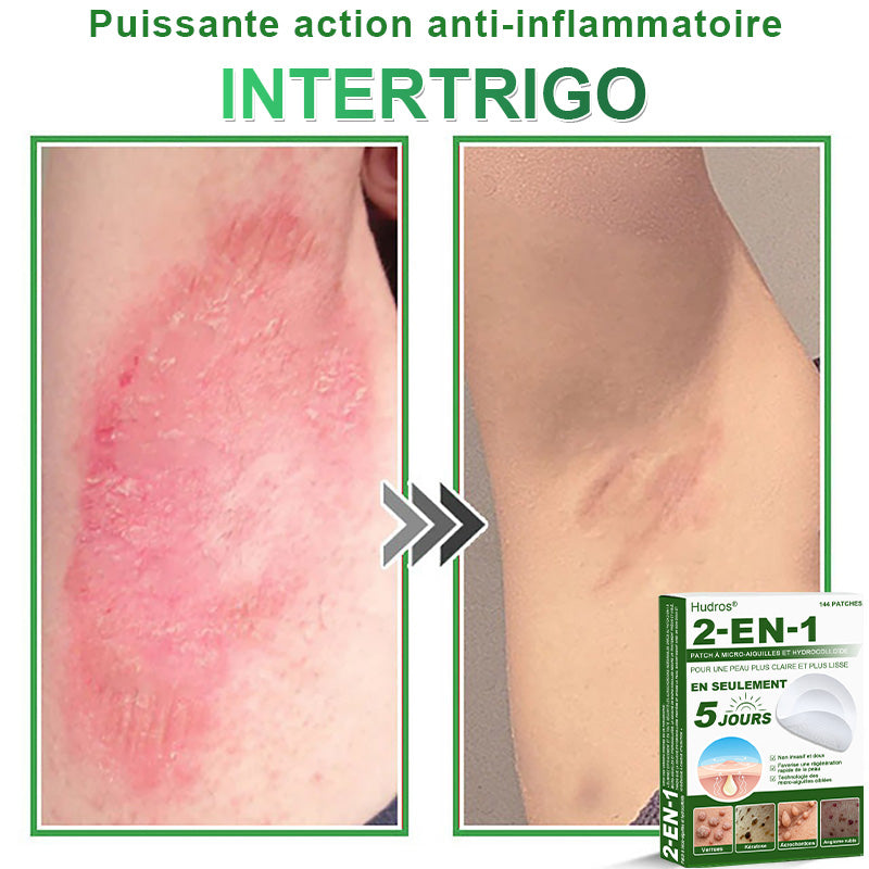 👩🏻‍⚕️Patchs hydrocolloïdes à micro-aiguilles 2 en 1 Hudros® | Élimine les grains de beauté en relief, l'acné, les verrues planes et les acrochordons | Patchs invisibles pour le visage et le corps | 144 patchs