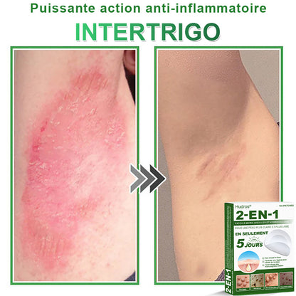 👩🏻‍⚕️Patchs hydrocolloïdes à micro-aiguilles 2 en 1 Hudros® | Élimine les grains de beauté en relief, l'acné, les verrues planes et les acrochordons | Patchs invisibles pour le visage et le corps | 144 patchs