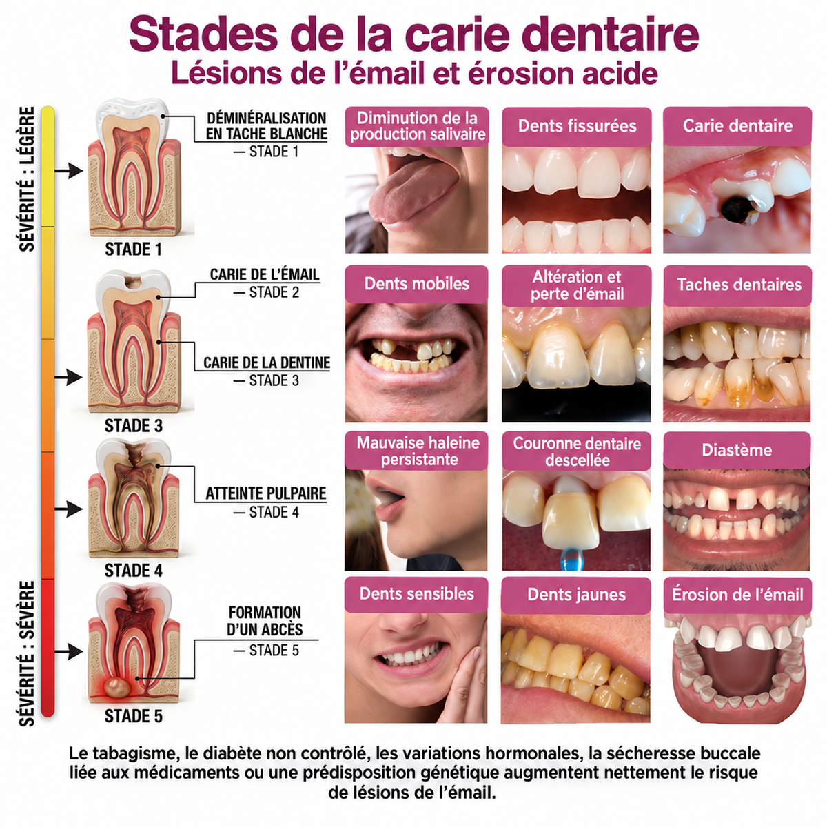 🇫🇷GarageLine® DenPerm🏆— Gel Réparateur de l’Émail Naturel pour Caries, Dents Sensibles & Émail Fragilisé