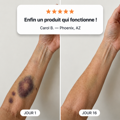 💥 Plus de 100 000 exemplaires vendus 💕 - CureVivo® Crème Réparatrice Anti-Bleus & Fortifiante