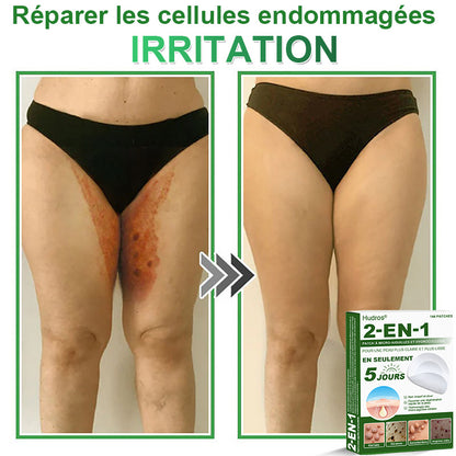 👩🏻‍⚕️Patchs hydrocolloïdes à micro-aiguilles 2 en 1 Hudros® | Élimine les grains de beauté en relief, l'acné, les verrues planes et les acrochordons | Patchs invisibles pour le visage et le corps | 144 patchs
